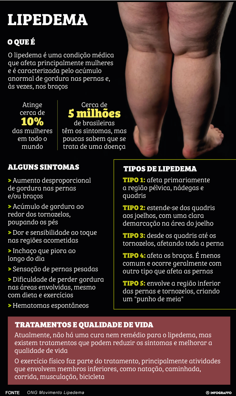 Infográfico do Dia