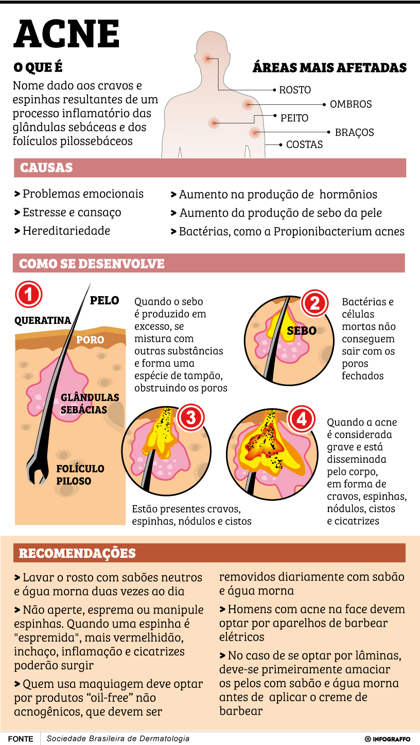 Infográfico do Dia