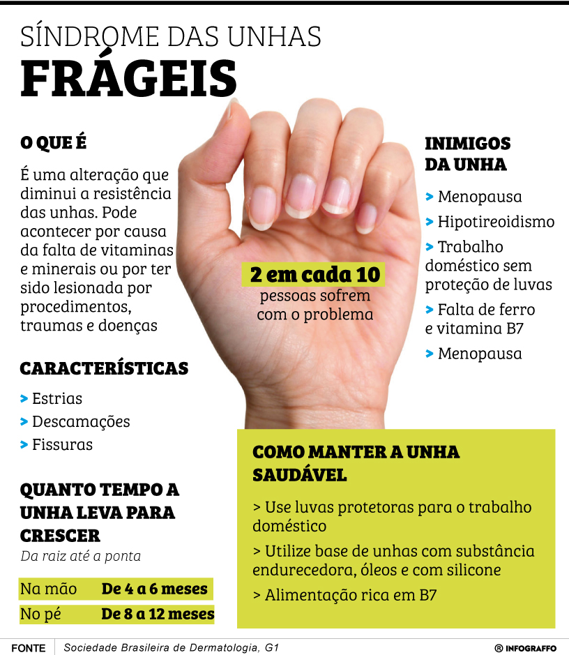 Infográfico